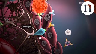 Using Methotrexate  Megans Story Medac Films 2011 [upl. by Nnednarb440]