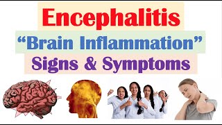 Encephalitis “Brain Inflammation” Signs and Symptoms amp Why They Occur [upl. by Nmutua]