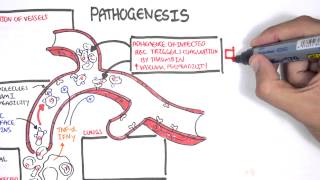 Malaria Pathophysiology [upl. by Elynad914]