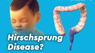 Hirschsprung Disease Treatment  Congenital Megacolon  Healing Frequencies  Repair Colon [upl. by Nyladnewg]