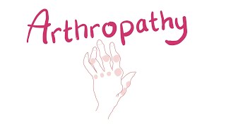 Arthropathy  Joint Pathology Classification [upl. by Ahab419]