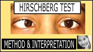 Hirschsprung Disease HD [upl. by Sheley]