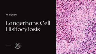 What is Langerhans Cell Histiocytosis [upl. by Rawna]