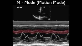 Ultrasound Physics Scanning Modes M Mode [upl. by Johnathan298]