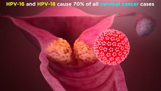 Human Papillomavirus HPV [upl. by Mayworm]