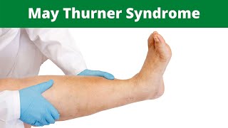 May Thurner Syndrome [upl. by Ainotahs]