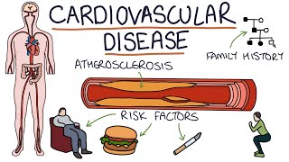 Intro to EKG Interpretation  Myocardial Infarctions Part 1 of 2 [upl. by Bilac634]