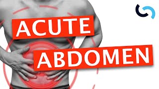 Acute Abdomen  Diagnosis and Management [upl. by Llehsal]