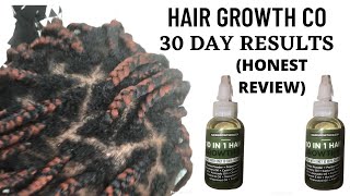 Hair Growth Co Oil 1 Month Results and Review [upl. by Eceinej340]