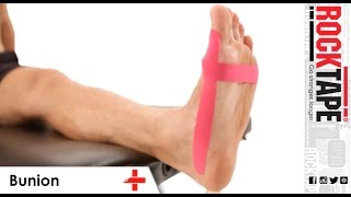 RockTape  Kinesiology Tape Instruction  Bunion [upl. by Bowen]