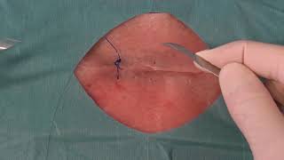 Fjerning av sutur  Suture removal [upl. by Burroughs]