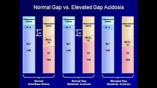 ABG Interpretation The Anion Gap Lesson 5 [upl. by Kenn]