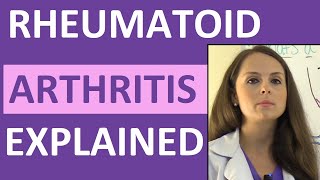 Rheumatoid Arthritis Treatment Options [upl. by Kape]