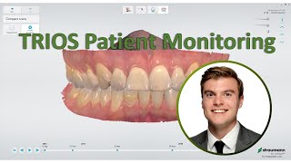 3shape TRIOS Patient Monitoring Wear and Ortho [upl. by Ennairoc145]