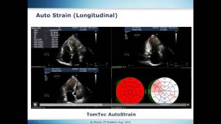 Strain Standardization [upl. by Baynebridge920]