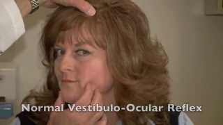 Ophthalmology History and Physical Part 12 [upl. by Chrisse591]