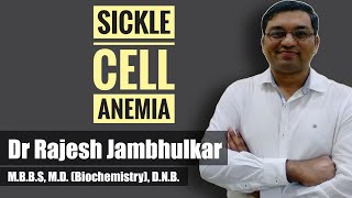 Sickle cell anemia [upl. by Katusha]