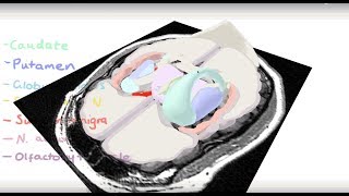 Basal Ganglia 3D Tour [upl. by Reham]