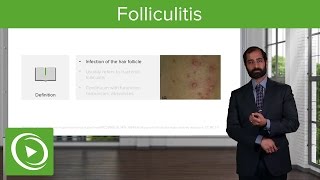 Infectious Skin Diseases Folliculitis – Pathology  Lecturio [upl. by Surad517]