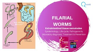 Filarial worms Wuchereria bancrofti Brugia malayi Mansonia Loa loa Onchocerca volvulus ampmore [upl. by Lalad702]