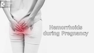 How to manage Hemorrhoids during Pregnancy  Dr Rashmi Chaudhary [upl. by Adar754]