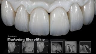 Mastering Monolithic Zirconia IN ENGLISH [upl. by Emmalyn]