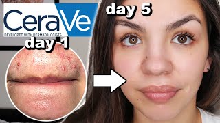 I Used CeraVe Skincare For One Week [upl. by Ailemac]