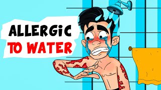 Im allergic to Water  My Story Animated [upl. by Jezabella730]