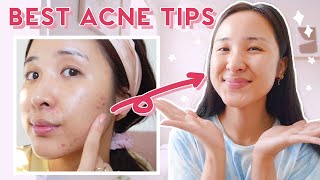 How to Use AHA BHA amp Niacinamide for ACNE amp HYPERPIGMENTATION 2021 [upl. by Boykins]