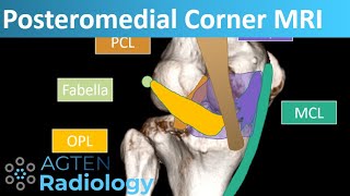 Posteromedial Corner Anatomy on Knee MRI [upl. by Merilyn198]