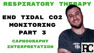 Respiratory Therapy  End Tidal CO2 Monitoring  Capnography [upl. by Llekcor798]