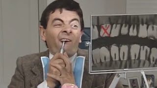 Dental Mental  Funny Clip  Classic Mr Bean [upl. by Sivatco]