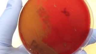 Microbiology  Hemolysis [upl. by Koeppel]