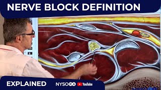 What is genicular artery embolization amp how to do it [upl. by Aleehs574]