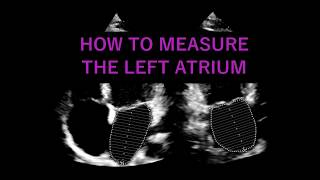 Measuring the LEFT ATRIUM VOLUME Echocardiography [upl. by Leighton]