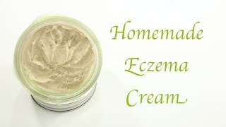 Homemade Eczema Cream [upl. by Annaoj]