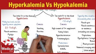 Hyperkalemia Vs Hypokalemia  EASY TO REMEMBER [upl. by Rocky583]