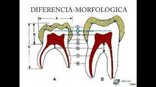 CARACTERÍSTICAS DE LA DENTICIÓN TEMPORAL [upl. by Bodnar]