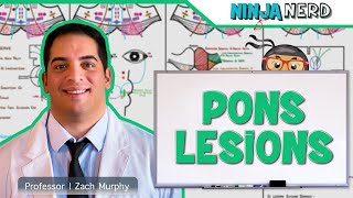 Pons Lesions [upl. by Ardnossak431]