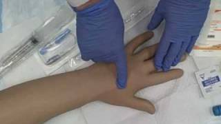 Intravenous IV Saline Lock Insertion [upl. by Ancell690]