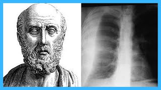 Top 12 Contributions of Hippocrates [upl. by Wenz913]