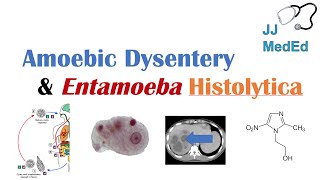 Amebiasis Amoebic Dysentery  Entamoeba histolytica Pathogenesis Signs amp Symptoms Treatment [upl. by Chrisman]