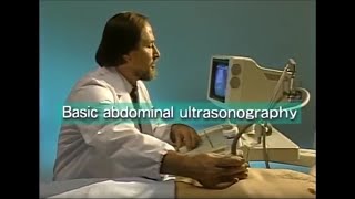 How to do abdominal ultrasound examination [upl. by Had566]