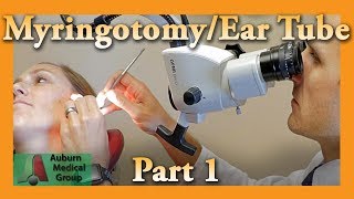 infection of the ear [upl. by Vigor]