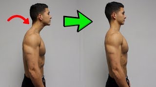 FIX Forward Head Posture Daily Corrective Routine [upl. by Snebur]