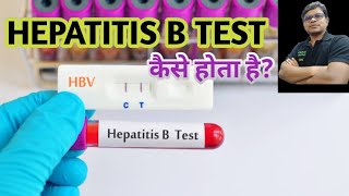 What is Hepatitis B DNA test in Hindi  HBV DNA PCR Quantitative test VIRAL LOAD Explained [upl. by Scarlet195]