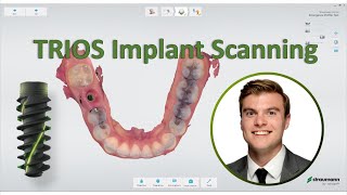 3shape TRIOS  Straumann Implant Scanning Workflow [upl. by Winifred251]