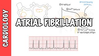 Atrial Fibrillation Overview  ECG types pathophysiology treatment complications [upl. by Burbank]