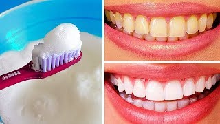 10 Maneiras Naturais de Clarear seus Dentes em Casa [upl. by Mickey]