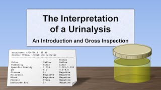 Interpretation of the Urinalysis Part 1  Introduction and Inspection [upl. by Nnylak471]